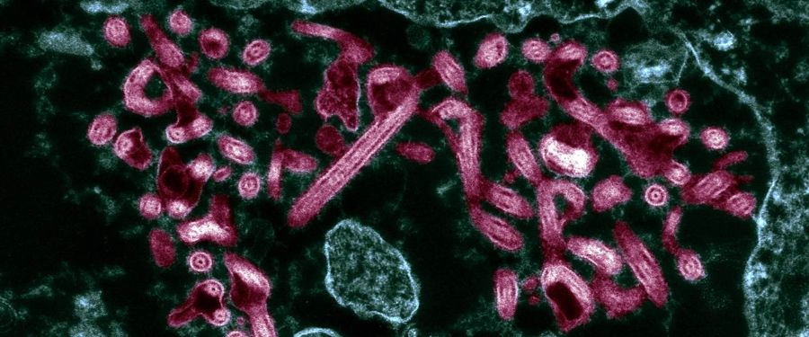 A+close+look+at+the+Ebola+Virus
