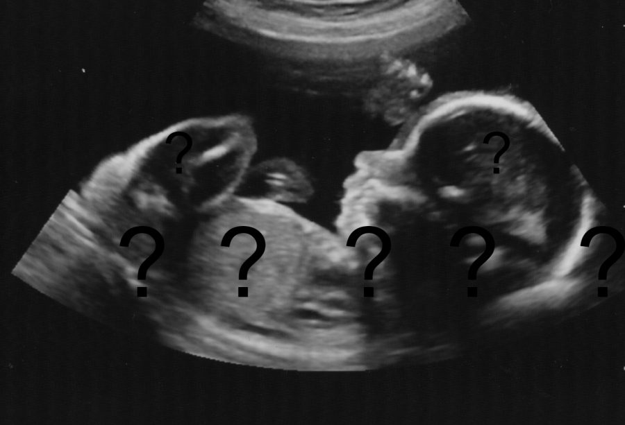 An ultrasound of a 6 month old child, the question marks represent the ability to change the child in order to fit your idea of a perfect child.