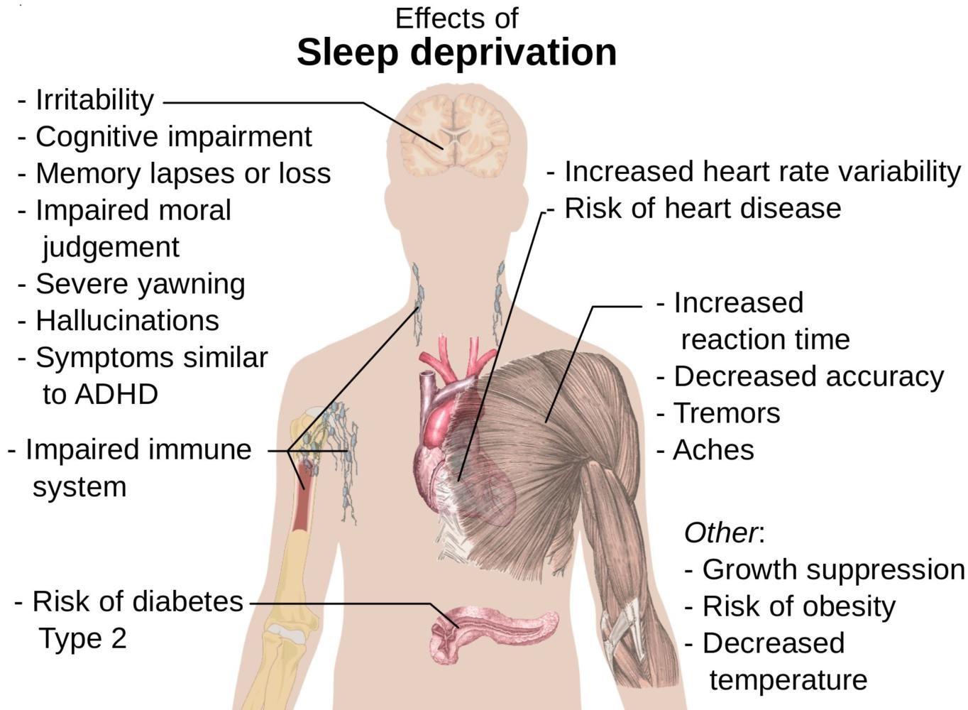 This diagram shows the several scary effects that prolonged sleep deprivation can have on individuals. 