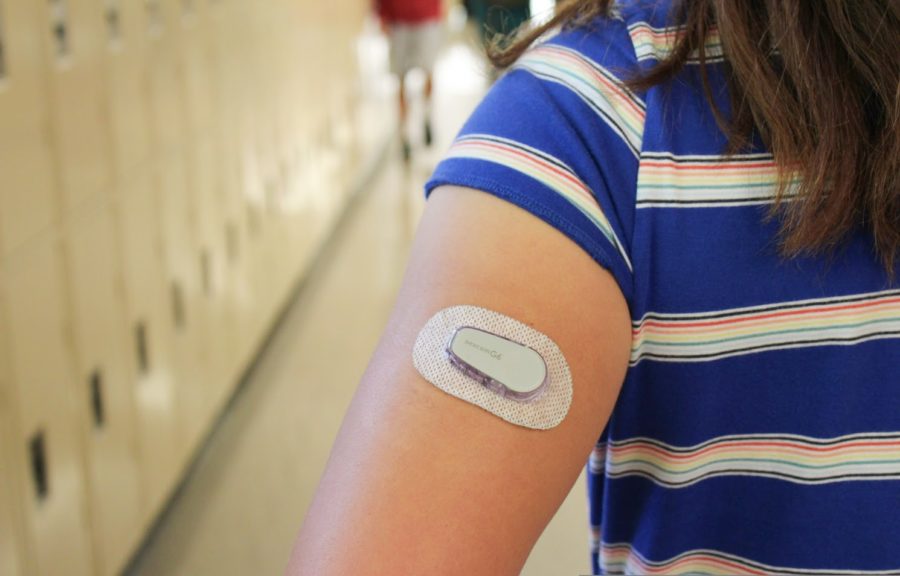 President Madeleine Cunninghams implanted glucose monitoring system helps to monitor her Type 1 diabetes. 