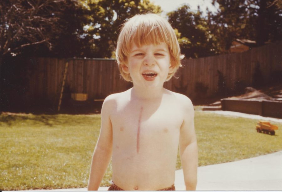 Bryan Beresford plays outside as a young child after his surgery.