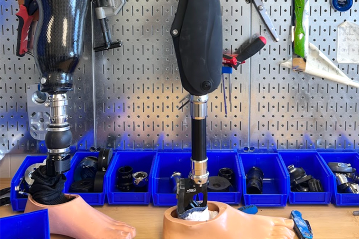At Applied Clinic, the prosthetic is assembled using advanced materials tailored to the patient’s needs. Each component is carefully combined to ensure optimal comfort, alignment, and functionality before the first fitting.